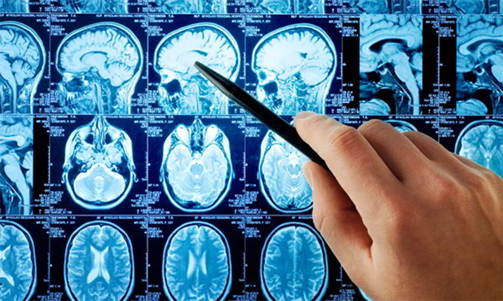 Relationship of Early Brain Connections and Development